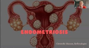 Reflexologia y Endometriosis