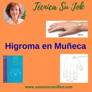 Higroma y Técnica Su Jok